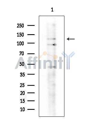 SMG8 Antibody - Western blot analysis of extracts from COLO205 cells(heat-shock treatment), using SMG8 Antibody.