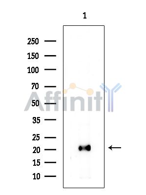 CYB5D2 Antibody - Western blot analysis of extracts from COLO205 cells(heat-shock treatment), using CYB5D2 Antibody.