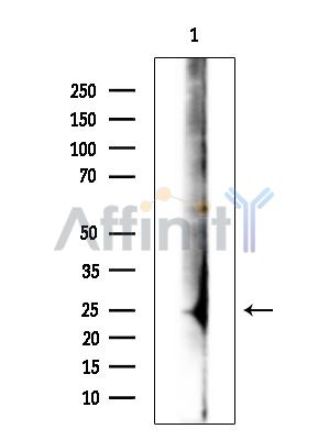 PIANP Antibody - Western blot analysis of extracts from Rat brain, using PIANP Antibody.