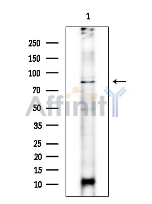 FAM161B Antibody - Western blot analysis of extracts from COLO205 cells(heat-shock treatment), using FAM161B Antibody.