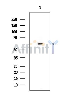 PLEKHG6 Antibody - Western blot analysis of extracts from Rat brain, using PLEKHG6 Antibody.