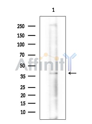 TRMT10C Antibody - Western blot analysis of extracts from COLO205 cells(heat-shock treatment), using TRMT10C Antibody.