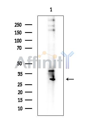CLRN3 Antibody - Western blot analysis of extracts from COLO205 cells(heat-shock treatment), using CLRN3 Antibody.