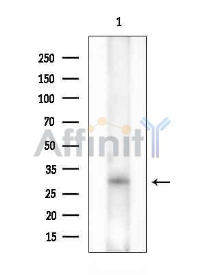 MAGF1 Antibody - Western blot analysis of extracts from EC304 cells(heat-shock treatment), using MAGF1 Antibody at 1/1000 dilution.