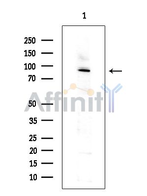 CAPN13 Antibody - Western blot analysis of extracts from COLO205 cells(heat-shock treatment), using CAPN13 Antibody at 1/1000 dilution.