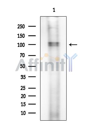 CEP68 Antibody - Western blot analysis of extracts from Rat brain, using CEP68 Antibody at 1/1000 dilution.