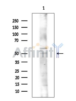 CNDP2 Antibody - Western blot analysis of extracts from COLO205 cells(heat-shock treatment), using CNDP2 Antibody at 1/1000 dilution.