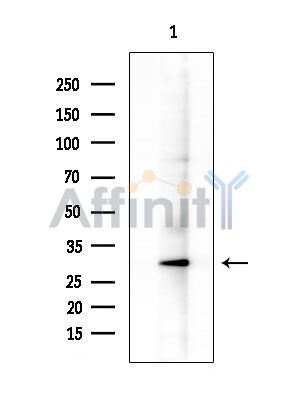 REM2 Antibody - Western blot analysis of extracts from COLO205 cells(heat-shock treatment), using REM2 Antibody at 1/1000 dilution.