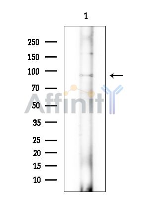 RHG6 Antibody - Western blot analysis of extracts from EC304 cells(heat-shock treatment), using RHG6 Antibody at 1/1000 dilution.