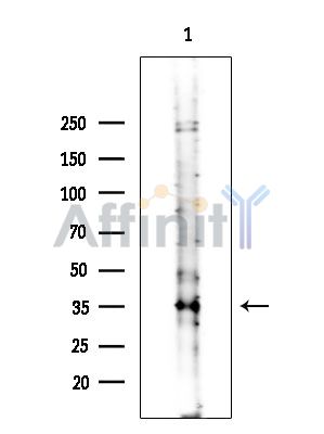 GRAP2 Antibody - Western blot analysis of extracts from COLO205 cells(heat-shock treatment), using GRAP2 Antibody at 1/1000 dilution.