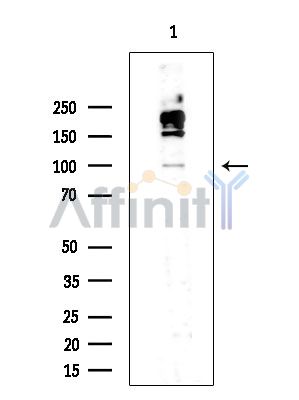 Phospho-IRE1 (Ser724) Antibody - Western blot analysis of extracts from COLO205 cells(heat-shock treatment), using Phospho-IRE1 (Ser724) Antibody at 1/1000 dilution.