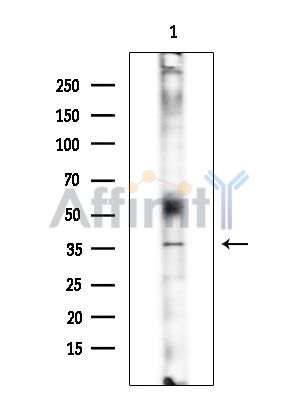 CrkL Antibody - Western blot analysis of extracts from COLO205 cells(heat-shock treatment), using CrkL Antibody at 1/1000 dilution.