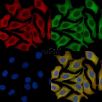 c-Kit Mouse Monoclonal Antibody - BF8286 staining HepG2 cells by IF/ICC.