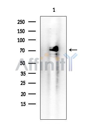 Gliomedin Antibody - Western blot analysis of extracts from Mouse brain, using Gliomedin Antibody at 1/1000 dilution.