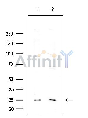 Synaptogyrin 2 Antibody - Western blot analysis of extracts from various samples, using Synaptogyrin 2 Antibody at 1/1000 dilution.