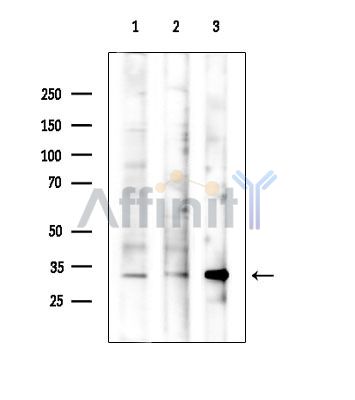 METRN Antibody - Western blot analysis of extracts from various samples, using METRN Antibody at 1/1000 dilution.