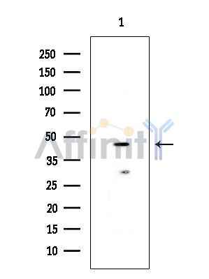 TXNDC6 Antibody - Western blot analysis of extracts from EC304 cells(heat-shock treatment), using TXNDC6 Antibody at 1/1000 dilution.