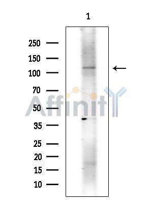 MORC3 Antibody - Western blot analysis of extracts from COLO205 cells(heat-shock treatment), using MORC3 Antibody at 1/1000 dilution.