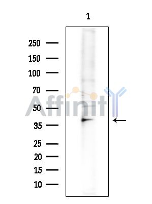 KCNK16 Antibody - Western blot analysis of extracts from COLO205 cells(heat-shock treatment), using KCNK16 Antibody at 1/1000 dilution.