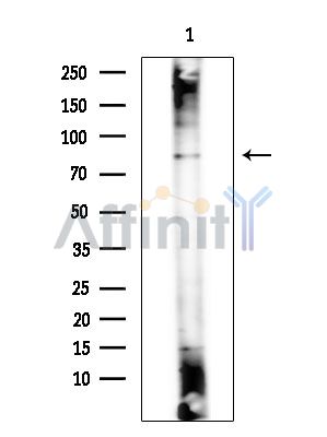 WRNIP1 Antibody - Western blot analysis of extracts from COLO205 cells(heat-shock treatment), using WRNIP1 Antibody at 1/1000 dilution.