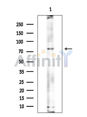 WRNIP1 Antibody - Western blot analysis of extracts from EC304 cells(heat-shock treatment), using WRNIP1 Antibody at 1/1000 dilution.