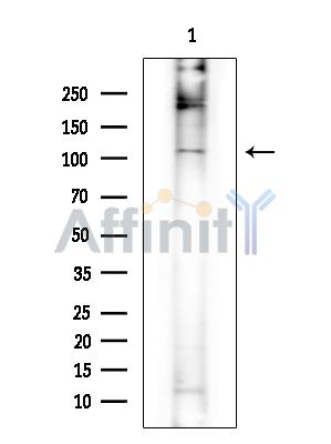 DENND1A Antibody - Western blot analysis of extracts from Rat brain, using DENND1A Antibody at 1/1000 dilution.