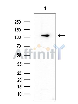 SCUBE1 Antibody - Western blot analysis of extracts from Rat brain, using SCUBE1 Antibody at 1/1000 dilution.