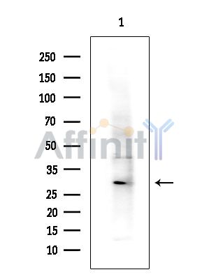 UBE2J2 Antibody - Western blot analysis of extracts from COLO205 cells(heat-shock treatment), using UBE2J2 Antibody at 1/1000 dilution.