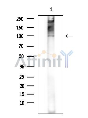 ZMYM1 Antibody - Western blot analysis of extracts from COLO205 cells(heat-shock treatment), using ZMYM1 Antibody at 1/1000 dilution.