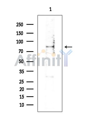 WAC Antibody - Western blot analysis of extracts from COLO205 cells(heat-shock treatment), using WAC Antibody at 1/1000 dilution.