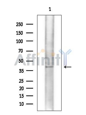 UQCC1 Antibody - Western blot analysis of extracts from COLO205 cells(heat-shock treatment), using UQCC1 Antibody at 1/1000 dilution.