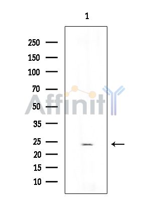 DSTN Antibody - Western blot analysis of extracts from Rat brain, using DSTN Antibody at 1/1000 dilution.