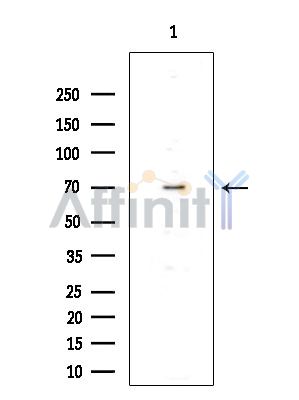 COLGALT1 Antibody - Western blot analysis of extracts from EC304 cells(heat-shock treatment), using COLGALT1 Antibody at 1/1000 dilution.