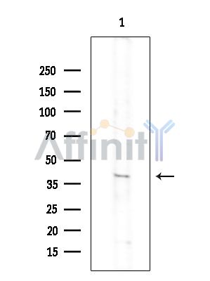 TRAIP Antibody - Western blot analysis of extracts from COLO205 cells(heat-shock treatment), using TRAIP Antibody at 1/1000 dilution.