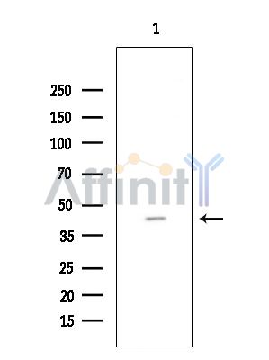 TRAIP Antibody - Western blot analysis of extracts from EC304 cells(heat-shock treatment), using TRAIP Antibody at 1/1000 dilution.