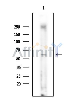 FLRT2 Antibody - Western blot analysis of extracts from Rat brain, using FLRT2 Antibody at 1/1000 dilution.