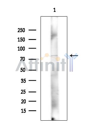 UNKL Antibody - Western blot analysis of extracts from COLO205 cells(heat-shock treatment), using UNKL Antibody at 1/1000 dilution.