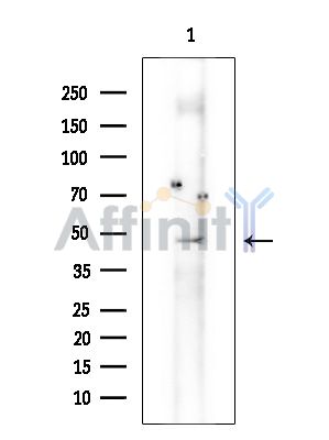 RGS6 Antibody - Western blot analysis of extracts from COLO205 cells(heat-shock treatment), using RGS6 Antibody at 1/1000 dilution.
