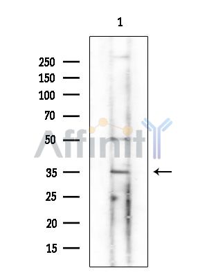 TOB2 Antibody - Western blot analysis of extracts from COLO205 cells(heat-shock treatment), using TOB2 Antibody at 1/1000 dilution.