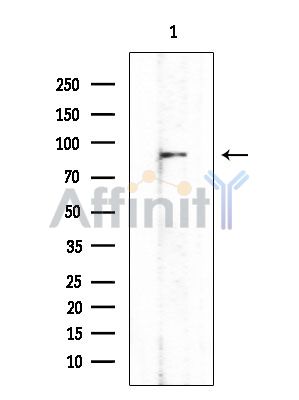 DSC3 Antibody - Western blot analysis of extracts from EC304 cells(heat-shock treatment), using DSC3 Antibody at 1/1000 dilution.