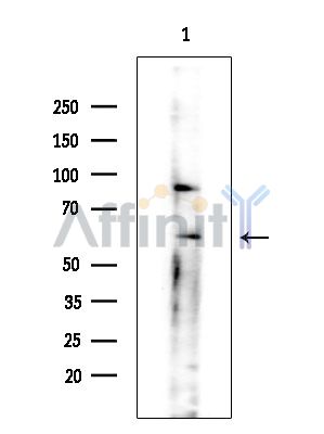 ARSD Antibody - Western blot analysis of extracts from Mouse testis, using ARSD Antibody at 1/1000 dilution.