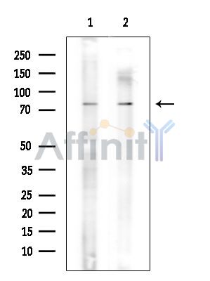 FAM111A Antibody - Western blot analysis of extracts from various samples, using FAM111A Antibody at 1/1000 dilution.