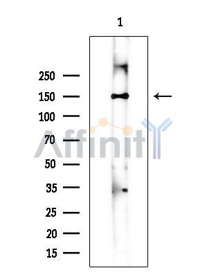 PAPPA Antibody - Western blot analysis of extracts from COLO205 cells(heat-shock treatment), using PAPPA Antibody at 1/1000 dilution.