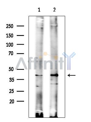 ABI3 Antibody - Western blot analysis of extracts from various samples, using ABI3 Antibody at 1/1000 dilution.