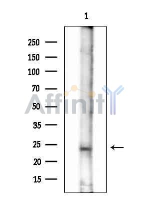 DOLPP1 Antibody - Western blot analysis of extracts from Rat brain, using DOLPP1 Antibody at 1/1000 dilution.