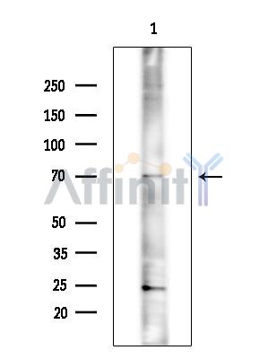 ISLR2 Antibody - Western blot analysis of extracts from EC304 cells(heat-shock treatment), using ISLR2 Antibody at 1/1000 dilution.