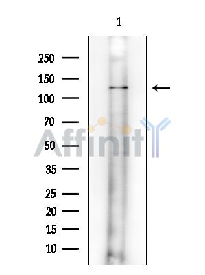 PLEKHH2 Antibody - Western blot analysis of extracts from Mouse testis, using PLEKHH2 Antibody at 1/1000 dilution.