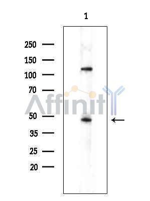 ZDHHC14 Antibody - Western blot analysis of extracts from COLO205 cells(heat-shock treatment), using ZDHHC14 Antibody at 1/1000 dilution.