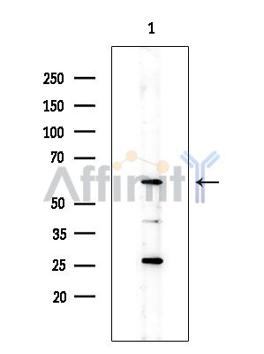 ZDHHC14 Antibody - Western blot analysis of extracts from Rat brain, using ZDHHC14 Antibody at 1/1000 dilution.