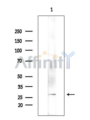 ARL14 Antibody - Western blot analysis of extracts from Rat brain, using ARL14 Antibody at 1/1000 dilution.